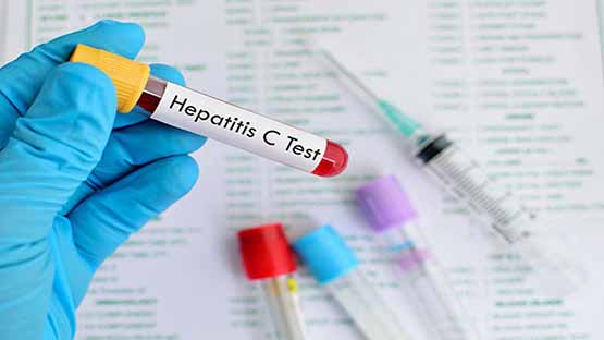 Pakistan handling with the world’s most noteworthy pace of Hepatitis Patients